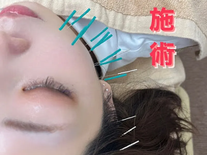 那覇 はり指圧 かんちゃん治療院